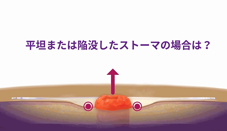 ダイアグラム