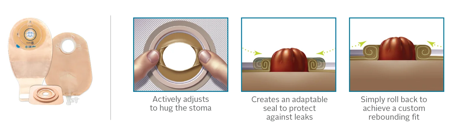 Stoma di forma irregolare - immagine del sito web