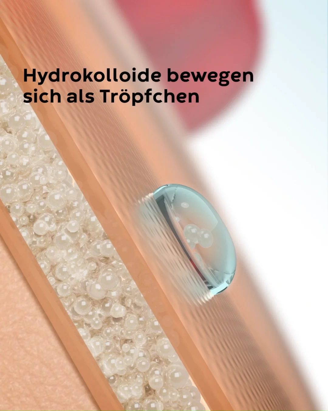 Video das zeigt wie Convatecs Hydrokolloide funktionieren