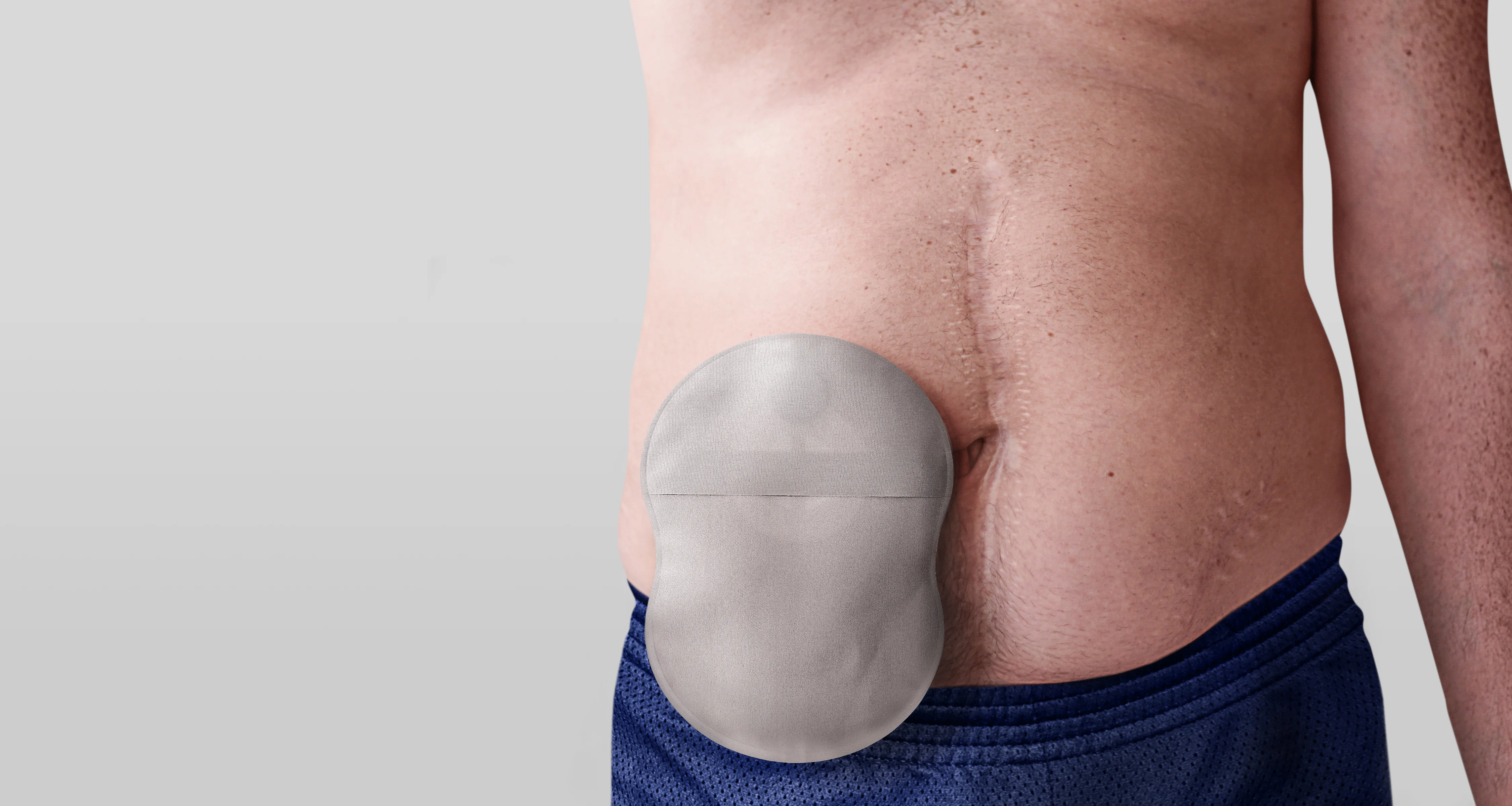 Man wearing an Esteem Body™ ostomy pouch